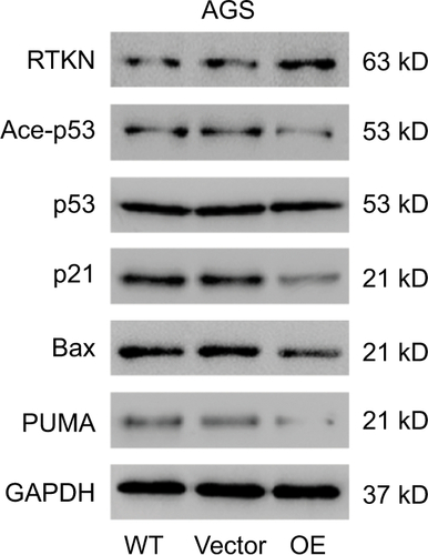 Figure S3 Effects of RTKN overexpression on the p53 pathway.Notes: AGS cells were treated with pLVX-RTKN (OE) or pLVX-puro (Vector). Protein levels of RTKN, p53, acetylated p53 (Ace-p53), and three p53 target genes were detected by Western blotting. Experiments were performed three times independently. Representative images for Western blotting are shown.