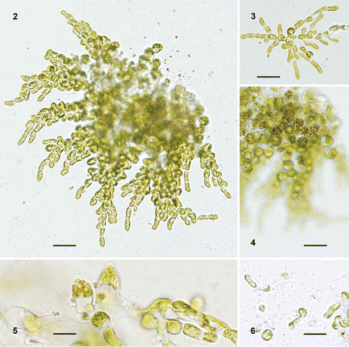 Figs 2–6. Ulvella elegans. 2. Mature plant with a pseudoparenchymatous central area and mutually free distal filaments. 3. Young plant of radiating filaments of cylindrical vegetative cells with a single pyrenoid. 4. Same plant as in Fig. 2 shown in different focus. 5. Barrel-shaped mature and empty sporangia. 6. Germlings. Scale bars = 20 µm (Figs 2–4) and 10 µm (Figs 5, 6).