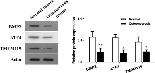 Figure 2 The relative protein expression of BMP2, ATF4 and TMEM119 in normal and osteonecrosis tissue detected by Western blotting. *p<0.05, **p<0.01 compared with normal tissues.