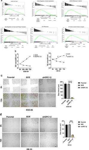 Figure 4a. Glypican 1 mediates growth and proliferation in esophageal cancer (a) the results of the Gene Set Enrichment Analysis (GSEA) identify pathways that exhibit a significantly impactful relationship of GPC-1 in EAC. (b) Stably expressing SCR and shGPC-1β expressing cell lines ESO-26 and OE-33 cells were evaluated for cell viability by CCK-8 assay at various time points. (c-d) Light microscopy images (magnification 20×) of scratch assay taken at 0 and 72 h after transfection. (e)light microscopy images (magnification 20×) of Transwell assay in either uncoated (for migration) or Matrigel-coated (for invasion) polycarbonate 8 µm chambers. Migrated cells at the bottom of inserts were stained with 0.1% crystal violet. (f) ESO-26 and OE-33 cells were transfected with scramble shRNA and shGPC-1β and grown for 14 days, stained with crystal violet, and the number of colonies was counted. (g) Western blot analysis (left) and densitometric analysis(right) of key proteins in EMT and stemness. Bar charts represent mean ±SD, n = 3. ns; not significant, *p < .05,**p < .01, ***p = .002, ****p < .001.