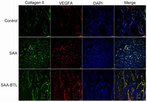 Figure 6 Immunofluorescence analysis of collagen II and VEGFA expression in fracture callus at the 4th week post-surgery. VEGFA and collagen II expression was quantified in sections of the callus. These data are shown in Figure 7D and E.