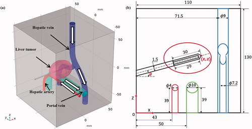 Figure 1. The geometric model of RFA for a liver tumor abutting a vascular structure: (a) a 3 D view and (b) X-Z cross-sectional view (with the variables (x,z,and θ) of electrode placement; dimension in mm and out of scale).