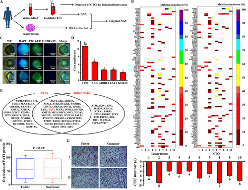 Figure 1 Genomic analysis identified FAT1. (A) Flow chart of the protocol for genomic analysis of CTC and tissue DNA. (B) CTC and tissue genomic variants in patients with HCC. (C) Fluorescence images of captured CTCs. (D) The top five genes with the highest mutation frequency. (E) Combined analysis of CTC and tissue gene mutations. (F) Analysis of FAT1 protein levels in ten patients with HCC (n = 10, rank sum test, *P < 0.05). (G) Representative IHC staining for FAT1 from HCC tissues and adjacent non-tumor tissues. Upper row (I, from left to right): FAT1 expression was higher in tumor tissues than in adjacent non-tumor tissue; lower row (II, from left to right): FAT1 expression was lower in tumor tissues than in adjacent non-tumor tissues.