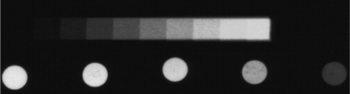 Figure 3. This radiograph of the experimental set-up shows the aluminium wedge and a series of 10×10 mm markers of increasing iodine concentration (0–720 mg/g).