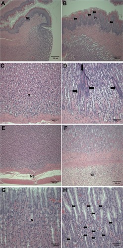 Figure 3 Histopathological changes in the stomach after treatment with ZnOAE100(−) at a dose of 500 mg/kg for 90 days. Stomach sections were stained with hematoxylin and eosin. (A) Control for limiting ridge. (C, E and G) Control for mucosa in glandular stomach. (B, D, F and H) 500 mg/kg treatment groups.aNotes: aArrows in (B) represent squamous cell vacuolation, in (D) show eosinophilic chief cells, in (F) indicate acinar cell apoptosis, and in (H) represent intracytoplasmic hyaline droplets.Abbreviations: H, squamous cell hyperplasia; N, normal mucosa; NE, normal epithelium; NS, normal submucosa; SI, submucosal edema and inflammatory cell infiltration; ZnO, zinc oxide, ZnOAE100(−), 100 nm negatively charged ZnO.