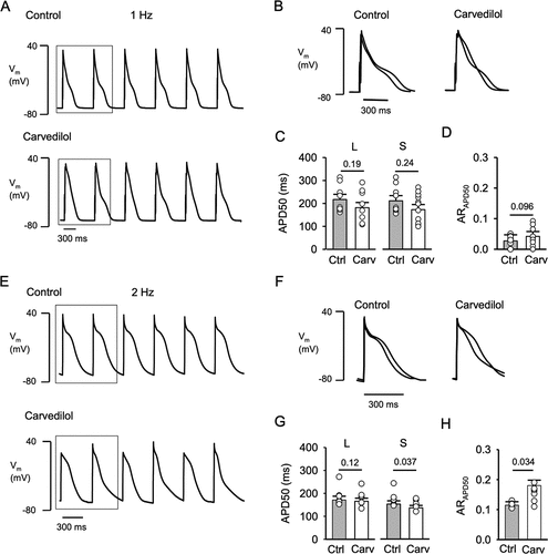 Figure 3. Carvedilol induces APD alternans. A, Representative AP traces recorded in control and in presence of carvedilol (0.75 µM) at 1 Hz. B, Overlay of 2 consecutive APs in control and carvedilol treated cells (marked by box in panel A). APs were recorded in current-clamp mode and evoked by 5 ms stimulation pulses of a magnitude ~1.5 times higher than AP activation threshold. C, APD of a pair of consecutive APs were classified as long (l) and short (s) based on APD50 analysis. Comparison of control and carvedilol mean APD50 of long (L: P = 0.19; n = 11) and short (S: P = 0.24) APs. D, ARAPD50 in control and after carvedilol (P = 0.096). E, Representative AP traces recorded in control and in presence of carvedilol (0.75 µM) at 2 Hz. F, Overlay of 2 consecutive APs in control and carvedilol treated cells (marked by box in panel E). G, Comparison of control and carvedilol mean APD50 of long (L: P = 0.12; n = 9) and short (S: P = 0.037) APs. H, Average ARAPD50 in control and after carvedilol treatment (P = 0.034). Statistical analysis with paired t-test.