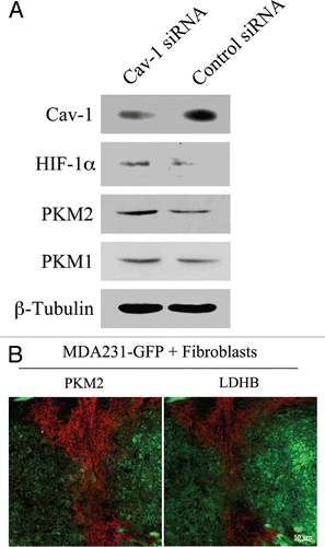 Figure 8 Cancer associated fibroblasts undergo a glycolytic switch in vitro and in vivo. (A) Cav-1 knock-down induces increased expression of glycolysis regulators in fibroblasts. hTERT-fibroblasts treated with Cav-1 siRNA or control siRNA were subjected to Western blot analysis with antibodies against HIF-1α, PKM2 and PKM1. Note that Cav-1 knock-down increases the expression of HIF-1α and PKM2, two master regulators of aerobic glycolysis in tumors. No significant differences in PKM1 levels were detected. β-tubulin was used as an equal loading control. (B) PKM2 and LDHB are expressed in the stroma of MDA-MB-231 cell xenografts. hTERT-fibroblasts and the highly aggressive human breast cancer cell line (MDA-MB-231) were co-injected in nude mice. After 2 weeks, xenograft tumors were harvested and analyzed by immunohistochemistry using PKM2 and LDHB antibodies (red). The MDA-MB-231 tumor cells were GFp (+) (green) and were detected by autofluorescence. Note that the two glycolytic enzymes PKM2 and LDHB are preferentially expressed in the tumor stroma. Consecutive frozen sections were stained in parallel