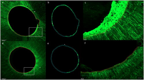 Figure 6. Confocal images representing the microleakage along the dentin tubules for both experimental groups in the middle root sections, group AH (photo a, b, and c) conventional sealer AH Plus Root Canal Sealer and group RC (photo d, e, and f) resin-based cement (ParaBond and ParaCore DENTIN SLOW). Left images: overview scans, middle images: fluorescence for quantification in working area and right images: magnifications of white rectangles in left images.