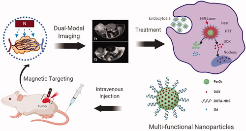 Scheme 1. Schematic illustration of the preparation of DOX@Gd-MFe3O4 NPs and magnetic tumor targeted T1/T2 MR imaging guided synergistic cancer therapy.