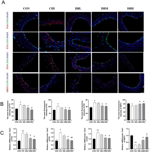 Figure 4. DBD Moderated aortic vessel senescence in CIH mice. (A) Representative immunofluorescence staining images of p16, p21, p53, and SIRT1 in aortic sections (scale bar = 50 μm). Nuclei are marked in blue, vascular endothelia in green, and target proteins in red. (B) Mean fluorescence intensities of p16, p21, p53, and SIRT1. (C) Relative mRNA levels of p16, p21, p53, and SIRT1. Data are expressed as the mean ± SEM, n = 3. (*p < 0.05 vs. CON group, **p < 0.01 vs. CON group; #p < 0.05 vs. CIH group, ##p < 0.01 vs. CIH group).