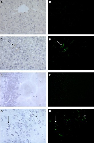 Figure 6 Representative histological images of the liver and brain in control rats and rats treated with 16 μM gH625.Notes: The left column shows bright-field images and the right column shows the fluorescein isothiocyanate channel. Each row represents the same field. The scale bar corresponds to 50 μm. (A, B) Liver section of negative control, (C, D) liver of treated animal showing Kupffer cell (arrows) overfilled with gH625, (E, F) a brain section from a negative control, and (G, H) brain of treated animals showing the presence of gH625 in nerve cell processes (arrows).