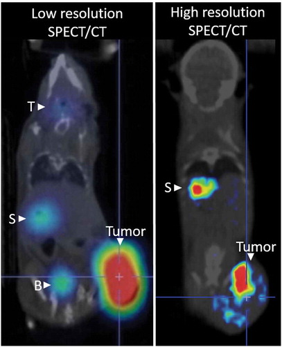 Figure 1. Representative whole body nuclear imaging of mice infected with oncolytic virus expressing NIS following NIS-mediated uptake of radiotracer. The thyroid (T), stomach (S) and bladder (B) can be detected due to endogenous NIS expression and radiotracer excretion. Low-resolution SPECT/CT imaging clearly identifies intratumoral radiotracer uptake. High-resolution SPECT/CT imaging allows for spatial resolution of intratumoral infected centers.