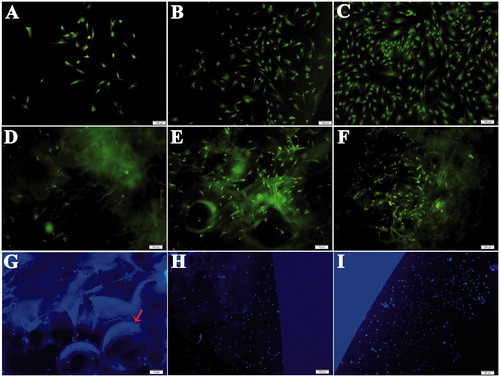 Figure 4. BMSCs were stained with AO/EB and Hoechst 33342. BMSCs in the leach liquor of scaffolds/MPs were stained with AO/EB cultured at (A) 3 days, (B) 5 days and (C) 7 days. BMSCs in scaffolds/MPs were stained with AO/EB and cultured at (D) 3 days, (E) 5 days and (F) 7 days. BMSCs in scaffolds/MPs were stained with Hoechst 33342 and cultured at (G) 3 days, (H) 5 days and (I) 7 days. The arrow indicates PLGA MPs (bar =100 μm).