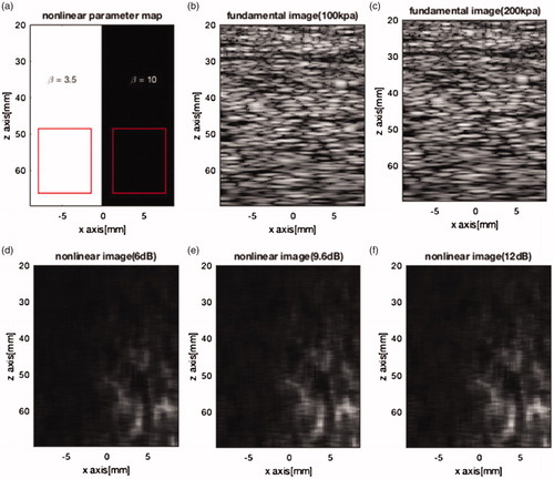 Figure 4. (a) Nonlinear map of half-space phantom with different acoustic nonlinear parameters (β) used in L(t) simulations. (b) and (c) The fundamental images of half-space phantom where the initial acoustic pressures are 100 kpa and 200 kpa, respectively. (d), (e) and (f) Nonlinear images of half-space phantom based on the nonlinear imaging function L(t) where the ratios A1/A2 are 6 dB, 9.6 dB and 12 dB, respectively.