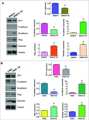 Figure 3. TMZ-resistant cells hade EMT marker changes. A. Left panel: Western blotting analysis was used to detect the expression of ZO-1, E-cadherin, N-cadherin, Slug, and Vimentin in SNB19 and SNB19/TR cells. Right panel: Quantitative results are illustrated for left panel. * P<0.05 vs control. B. Left panel: Western blotting analysis was performed to measure the expression of ZO-1, E-cadherin, N-cadherin, Slug, and Vimentin in T98G and T98G/TR cells. Right Panel: Quantitative results are illustrated for left panel. * P<0.05 vs control.