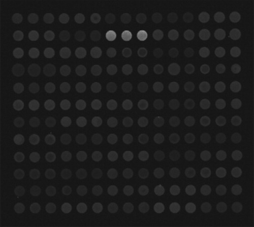 Figure 15. Microarray points from Boao scanner test result.