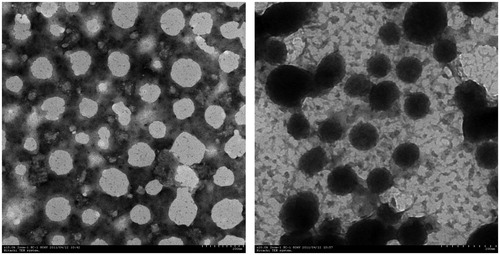 Figure 7. TEM of blank (left) and HCPT-loaded (right) CTS-g-PNIPAAm nanogels. Scale bars are 200 nm.