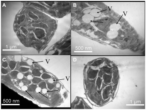 Figure 4 Transmission electron micrographs through sections of (A) untreated control parasite in Roswell Park Memorial Institute medium; (B) microfilariae treated with staurosporine (0.5 μM); (C) microfilariae treated with silver nanoparticles (50 μM); and (D) microfilariae treated with gold nanoparticles (50 μM).Notes: Arrows point to the vacuoles; data are representative of three different experiments.Abbreviation: V, vacuoles.