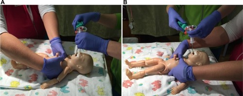 Figure 3 Chest compression administered from the foot of the bed (A) and the head of the bed (B).