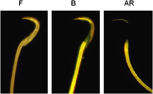 Figure 1 Chlortetracycline staining patterns in rat spermatozoa during capacitation. This figure shows the three patterns of staining seen in rat spermatozoa after incubation in mRFM for 5 h (see Materials & Methods): the “F” pattern, characteristic of noncapacitated, acrosome-intact spermatozoa; the “B” pattern, characteristic of capacitated, acrosome-intact spermatozoa with null staining in the postacrosome area; and the “AR” pattern, characteristic of capacitated acrosome reaction spermatozoa.