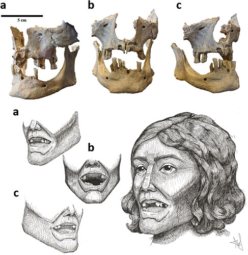 Fig 8 HRU 2828: Juxtaposition of skeletal images and artistic reconstructions. a) Right aspects of the face and oral cavity; b) Anterior; c) Left. Photographs by Trent Trombley and drawings by Alexandra Farnsworth.