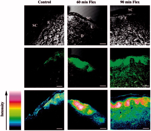 Figure 20. Confocal scanning microscopy images of intact skin dosed with Baa-Lys(FITC)NLS for 8 h (FITC: fluorescein isothiocyanate; NLS: Pro-Lys-Lys-Lys-Arg-Lys-Val). Top row: confocal-differential interference contrast (DIC) channel image shows an intact stratum corneum (SC) and underlying epidermal (E) and dermal layers (D). Middle row: Baa-Lys(FITC)-NLS fluorescence channel (bright area) and confocal-DIC channel show [60]fullerene penetration through the epidermal and dermal layers of skin. Bottom row: fluorescence intensity scan showing Baa-Lys(FITC)-NLS penetration. All scale bars represent 50 μm. Reproduced with permission from Rouse JG et al.Citation49.