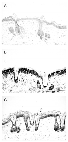 Figure 3. Reduction of UV-induced IL-6 expression by topical application of 1,25(OH)2D3 in mouse skin. Immunohistochemical detection of IL-6 in Skh:hr1 hairless mice skin was with a monoclonal antibody to IL-6 and a biotinylated secondary rabbit anti-goat IgG. Figures are representative dorsal skin sections (A) non-irradiated skin or (B) after solar simulated radiation followed by 48-h treatment with vehicle or (C) after solar simulated radiation followed by 48-h treatment with 1,25D (22.8 pmol/cm2). Reprinted from The Journal of Steroid Biochemistry and Molecular Biology. R.S. Mason, V.B. Sequeira, K.M. Dixon, C. Gordon-Thomson, K. Pobre, A. Dilley, M.T. Mizwicki, A.W. Norman, D. Feldman, G.M. Halliday, V.E. Reeve (2010).