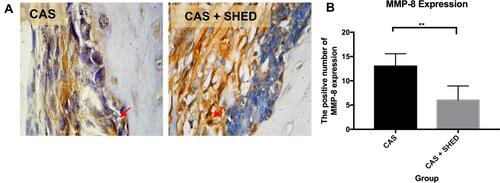 Figure 4 The periodontal tissue histological section of an afflicted subject. (A) AbMo and DAB were used to perform immunohistochemical analysis of MMP-8 expression. Positive cells appeared brown in color (red arrow) through a light microscope at 1000x magnification. (B) The number of positive expressions of MMP-8 is shown. The statistical significance of differences between groups was examined by means of an unpaired t-test (n = 7; **Information: significant at p < 0.01).