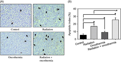 Figure 4. (A) TUNEL-positive apoptotic cells in FSaII tumours three days after various treatments. Arrows indicate apoptotic cells. (B) Apoptotic index (%) three days after treatments. The number of apoptotic cells (total of 1000 nuclei) in 10 fields randomly selected in each of three tissue sections per tumour was obtained. Means of five tumours ±1 SE are shown. *indicates p < 0.05.