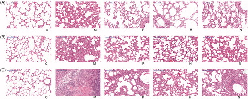 Figure 1. Histopathological images of rat left lung tissues: (a) 15 days after drug treatment. (b) 30 days after drug treatment. (c) 45 days after drug treatment. C, the control group that is not induced into idiopathic pulmonary fibrosis; M, the model group that has been induced into idiopathic pulmonary fibrosis; P, the idiopathic pulmonary fibrosis model group that is treated by pirfenidone; H, the idiopathic pulmonary fibrosis model group that is treated by prednisone; N, the idiopathic pulmonary fibrosis model group that is treated by acetylcysteine. The scale bars were 200 μm.
