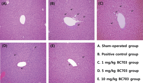Figure 4.  Histopathological changes of the liver stained with hematoxyline and eosin on the bile duct ligation (BDL)-induced liver injury (×100). Mice were given orally BC703 (0, 1, 5, and 10 mg/kg) once daily for 3 consecutive days prior to BDL. (A) nontreated sham-operated group; (B) nontreated BDL group; (C) BC703 (1 mg/kg) treated BDL group; (D) BC703 (5 mg/kg) treated BDL group; (E) BC703 (10 mg/kg) treated BDL group. Arrows indicate the bile duct proliferation and hepatocyte necrosis.