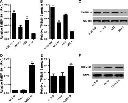 Figure 2 TMEM119 was highly expressed in gastric cancer cell lines. TMEM119 mRNA and protein expression in gastric cancer cell lines, including SGC-7901, AGS, and MKN45, and gastric epithelial cell line GES-1 was measured by real-time PCR (A) and Western blotting (B and C), respectively. TMEM119 mRNA and protein expression in MKN45 cells with recombined pLVX-Puro-TMEM119 vector transfection was measured by real-time PCR (D) and Western blotting (E and F). **P<0.01 compared with GES-1 cells or vector.