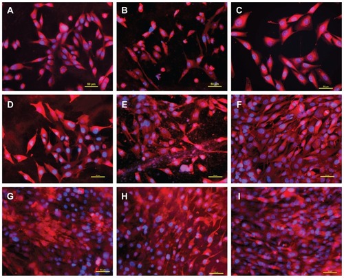 Figure 6 Morphology of human osteoblast-like MG-63 cells on days 1 (A–C), 3 (D–F), and 7 (G–I) after seeding on pure PLGA scaffolds (A, D, and G), composite PLGA-ND scaffolds (B, E, and H), and a polystyrene culture well (C, F, and I). The cell membrane and cytoplasm were stained with Texas Red C2-maleimide (red fluorescence), and the cell nuclei with Hoechst 33342 (blue fluorescence).Notes: A Nikon Eclipse Ti-E microscope, objective 20 × 1.5; Nikon DS-Qi1 MC digital camera, NIS-Elements AR software, version 3.10, were used. Summarization of Z-sections with deconvolution, bar 50 μm.Abbreviations: PLGA, copolymer of L-lactide and glycolide; ND, nanodiamond.