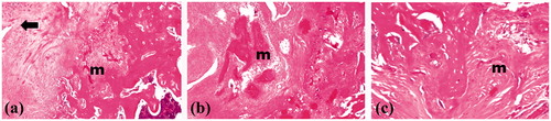Figure 8. Photographs of treated rat femur treated with formula F16 showing osteoblasts (→) and remodeling (m) phase of bone healing at magnifications of (a) 16×, (b) 40× and (c) 64×.