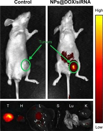Figure 9 In vivo fluorescence imaging of tumor-bearing mice, excised tumor and organs after administration of RGDfC-SeNPs@DOX/cy5.5-siRNA at 4 h.Abbreviations: DOX, doxorubicin; NPs, nanoparticles; NPs@DOX/siRNA, RGDfC-SeNPs@DOX/cy5.5-siRNA; RGDfC, Arg-Gly-Asp-D-Phe-Cys peptide; SeNPs, selenium nanoparticles; T, tumor; H, heart; L, liver; S, spleen; Lu, lung; K, kidney.