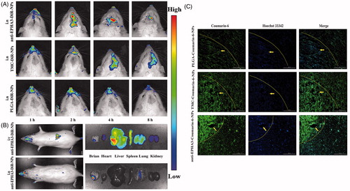 Figure 3. In vivo and brain distribution of DiR- and coumarin-6-loaded NPs in glioma-bearing rats. (A) In vivo fluorescence imaging at predetermined time points after intranasal administration of DiR-loaded NPs. (B) In vivo and excised tissues imaging of anti-EPHA3-modified DiR-loaded NPs at 4 h after intranasal and intravenous administration. (C) Fluorescence microscopy images of the brain, acquired 4 h after intranasal administration of coumarin-6-loaded NPs to glioma-bearing rats. Green: coumarin-6; blue: Hoechst 33342 (nuclei); yellow arrows point to the tumor site. DiR, 1,-1-dioctadecyl-3,-3,-3′,-3′-tetramethylindotricarbocyanine; NPs: nanoparticles.