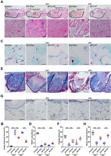 Figure 4 Histological analysis of tooth extraction sockets in each group (Control: natural healing group; Zol+Dex: Zol+Dex and saline treated group; sEV-AT: Zol+Dex and sEV-AT treated group). (A) Representative HE-stained images of tooth extraction sockets (black dotted line: tooth extraction sockets, red dotted line: necrotic bones, black square: areas were magnified). Scale bar=1mm (upper), scale bar=100 µm (lower). (B) The percentage of empty osteocyte lacunae (***p < 0.001). (C) Representative TRAP-stained images of tooth extraction sockets (white arrowhead: TRAP positive cells). Scale bar=50 µm. (D) The number of TRAP positive cells per linear bone perimeter (***p < 0.001). (E) Representative masson’s trichrome-stained images of tooth extraction sockets (black dotted line: tooth extraction sockets of mesial roots). Scale bar=500 µm. (F) The area percentage of collagen fibers (***p < 0.001). (G) Representative anti-VEGFA immunohistochemical images of tooth extraction sockets (white arrowhead: VEGFA positive blood vessels). Scale bar=100 µm. (H) The number of VEGFA positive blood vessels (***p < 0.001).