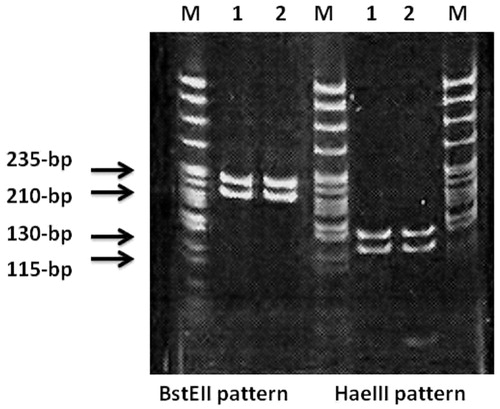 Figure 4. PRA pattern of Mycobacterium gordonae in 3% agarose gel stained with ethidium bromide. M, molecular weight marker (50-bp ladder); 1, negative control; 2, BstEII 245/120/80 bp and HaeIII 160/140/70 bp; M. tuberculosis H3RV (ATCC 27294); 3, BstEII 235/210 bp and HaeIII 130/115 bp; M. gordonae isolate.