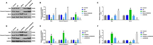 Figure 6. The effects of CDKN1B, siCDKN1B alone and combined with miR-342-5p on the expressions of apoptotic genes. A: The expressions of apoptotic genes were detected by WB, after transfection with mimic or/and CDKN1B. B: CDKN1B partially reversed the effect of mimic on apoptotic genes expressions. C: CDKN1B partially reversed the effect of mimic on the mRNA expressions of apoptotic genes. D: The expressions of apoptotic genes were detected by WB, after transfection with inhibitor or/and siCDKN1B. E: SiCDKN1B partially reversed the effect of inhibitor on apoptotic genes. F: SiCDKN1B partially reversed the effect of inhibitor on the mRNA expressions of apoptotic genes. *p < 0.05 vs. control, **p < 0.01 vs. control; #p < 0.05 vs. NC, ##p < 0.01 vs. NC; ^p < 0.05 vs. mimic or inhibitor, ^^p < 0.01 vs. mimic or inhibitor; △p < 0.05 vs. CDKN1B or siCDKN1B, △△p < 0.01 vs. CDKN1B or siCDKN1B.