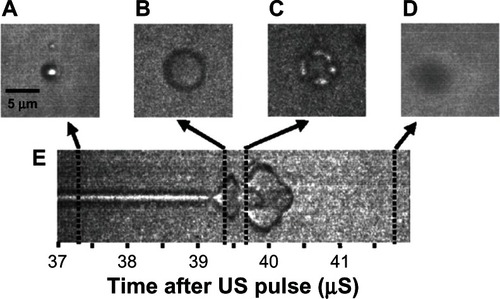 Figure 4 Streak camera images of a microbubble undergoing size oscillations when exposed to ultrasound. (A) The original resting size of the microbubble. (B) As the ultrasound pulse hit the microbubble the rarefaction portion caused the microbubble to expand. (C) The microbubble was destroyed, and remnant gas fragments were left behind. (D) All the remnant gas dissolved into the water. (E) A streak camera image showing only the width of the microbubble as a function of time, documenting how the diameter changed over the course of the ultrasound exposure.Reprinted with permission from Bloch SH, Wan M, Dayton PA, Ferrara KW. Optical observation of lipid-and polymer-shelled ultrasound microbubble contrast agents. Appl Phys Lett. 2004;84(4):631–633. Copyright 2004, American Institute of Physics.Citation58