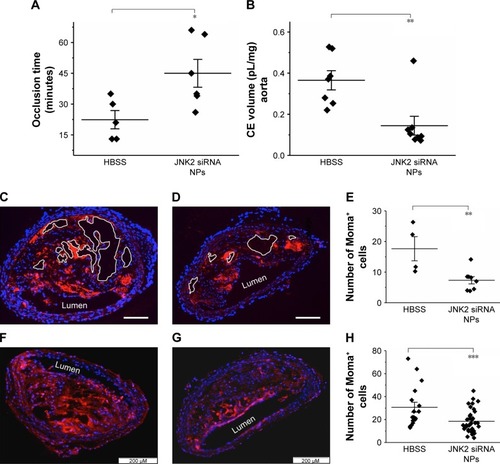 Figure 2 p5RHH-JNK2 siRNA NPs reduce thrombotic risk, restore endothelial integrity, and decrease necrotic plaque area and macrophages.Notes: (A) Shorter occlusion times for untreated ApoE−/− mice indicate more aggressive clotting (ie, heightened thrombotic risk) compared to mice treated with p5RHH-JNK2 siRNA NPs (n=6), which manifest prolonged occlusion times compared to HBSS control (n=5, P=0.02). (B) 19F MRS demonstrates significantly less perfluorocarbon (CE volume) NP accumulation in ApoE−/− mice after p5RHH-JNK2 siRNA NP treatment (n=8) compared to those treated with HBSS (n=7) (P=0.003), confirming restoration of endothelial barrier integrity that now prohibits passive permeation of perfluorocarbon NPs. (C and D) Representative aorta sections demonstrate that necrotic plaque area is reduced in p5RHH-JNK2 siRNA NP-treated animals (D) (n=8) compared to those treated with HBSS (C) (n=4, bar 100 μm). (E) Necrotic plaque areas from mice treated with p5RHH-JNK2 siRNA NPs are reduced compared to mice receiving HBSS (P=0.004). (F and G) Representative immunofluorescence stains demonstrate significantly fewer Moma-positive cells in atherosclerotic plaque from ApoE−/− mice treated with p5RHH-JNK2 siRNA NPs (G) (n=36) compared to HBSS control mice (F) (n=17, P<0.001; scale bars: 200 μm). (H) Quantification of Moma-positive cells in the intima. Unpaired two-sided Student’s t-test used for statistical analysis and data presented in dot plots with means ± standard error. *P<0.05; **P<0.01; ***P<0.001.Abbreviations: CE, perfluoro-15-crown-5-ether; HBSS, Hanks’ Balanced Salt solution; MRS, magnetic resonance spectroscopy; NPs, nanoparticles.