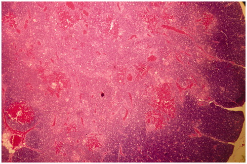 Figure 6. Thymus of broiler chick administered chlorpyrifos (10 mg/kg BW) at day 15 of treatment. Representative photomicrograph shows congestion and degenerative changes. H&E stain. Magnification = 40×.