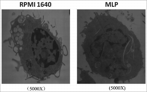 Figure 1. Structural changes of bone marrow-derived cells (BMDCs) treated with mulberry leaf polysaccharides(MLPs) under transmission electron microscopy (TEM). BMDCs, post treatment with MLPs for 48h, were centrifuged, dispensed in 0.5 mL 0.05M pH 7.2 PBS, ﬁxed in 2.5% glutaraldehyde by 1% osmium teroxide overnight, dehydrated in ethanol and embedded in epon. Prepared sections placed on a Reichert-Jung Ultracut E were stained with uranyl acetate and lead citrate. The sample was analyzed under TEM for BMDC intracellular structure changes.