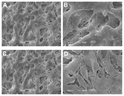 Figure 4 (A and B) Adhesion of MG63 osteoblast-like cells on day 1 on the nHA/PA66 membrane (SEM * 400)/(SEM * 1000). (C and D) Adhesion of MG63 osteoblast-like cells on day 5 on the nHA/PA66 membrane (SEM * 400)/(SEM * 1000).Abbreviations: PA66, polyamide-66; SEM, scanning electronic microscope.