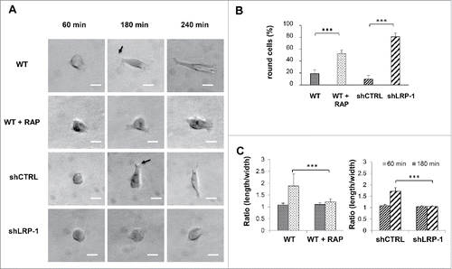 Figure 3. LRP-1 blockade or silencing impacts the FTC-133 carcinoma cell morphology on 3D collagen matrix. (A) Cells were seeded within 3D type I collagen matrix. Typical morphology of cells cultured within 3D matrix was obtained by phase contrast microscopy. Arrows show examples of nascent thin projections. Bar: 100 μm. (B) Percentage of round cell was calculated by using 30 isolated cells (180 min after seeding) for each condition in 3 independent experiments. ***, P < 0.001. (C) Ratio (length/width) was calculated using Image J software by using 20 isolated cells (60 min and 180 min after seeding) for each condition in 3 independent experiments. ***, P < 0.001.