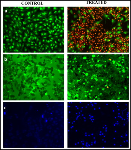 Figure 7. The effect of green synthesized AuNPs from C. racemosa on human lung cancer (H460) cells: (a) Morphology changes marked in arrow – AO/EB dual staining assay, (b) ROS generation – DCFH-DA staining, (c) nuclei condensation – Hoechst 33258 staining assay (scale: 100 μm).