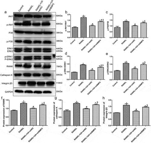 Figure 7. Protein expression levels of Akt1/p38/ERK pathway-related proteins and osteoclastic proteins RANK, cathepsin K, and integrin β3 detected by Western blotting. (a) Representative Western blot images. The levels of (b) phosphorylated (p)-Akt1/Akt1, (c) p-P38/P38, (d) p-ERK1/ERK1, (e) p-ERK2/ERK2, (f) RANK, (g) cathepsin K, and (h) integrin β3 are shown. *P < 0.05 shows significance compared with the untreated shNC group; #P < 0.05, with the RANKL-treated shNC group; $P < 0.05, with the RANKL + UA-treated shNC group.