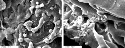 Figure 2 Scanning electron microscopy of equivalents after 24 hours culture. A) Cells formed aggregates on the surface of the sponges. B) Cells formed aggregates inside the sponges. Intercellular junctions (upper arrow) and cell-matrices junctions were seen (lower arrow).