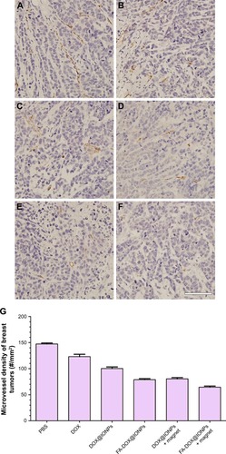 Figure 10 Representative micrographs of CD31 immunohistochemistry of breast cancer cells in mice treated with (A) PBS, (B) free DOX, (C) DOX@IONPs, (D) FA-DOX@IONPs, (E) DOX@IONPs plus magnetic treatment, and (F) FA-DOX@IONPs plus magnetic treatment. (G) Microvascular vessels staining and AMVD (the number of microvessels per mm2) of mice breast cancer tumors. Scale bar =100 μm.Abbreviations: DOX, doxorubicin; FA, folic acid; IONP, iron oxide nanoparticle; AMVD, average microvessel density.