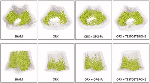 Figure 4. Representative images of bone trabecular 3D microarchitecture in femur sections in groups obtained by computed microtomography. Three-month-old male Wistar rats: Sham-operated rats (SHAM) and orchidectomized rats (ORX) as baseline and castrated rats treated with 10 mg/kg/twice a week of OPG–Fc (ORX + OPG–Fc) or testosterone cypionate (1.7 mg/kg/once a week) (ORX + testosterone).